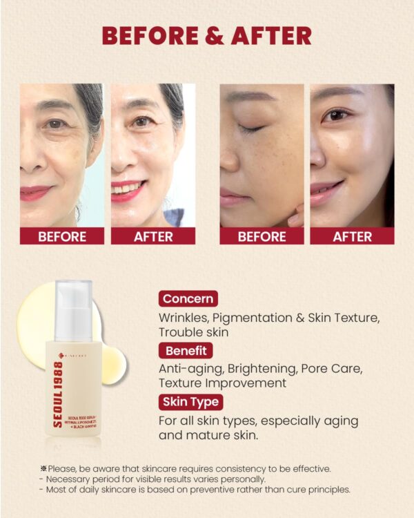 KSECRET SEOUL 1988 Serum : Retinal Liposome 2% + Black Ginseng, 30ml/1.01fl.oz | 58% Black Ginseng Extract | Retinal serum, Bakuchiol, VitaminC&3Peptides for Wrinkle Care | Korean Skincare | seoul1988 - Image 2
