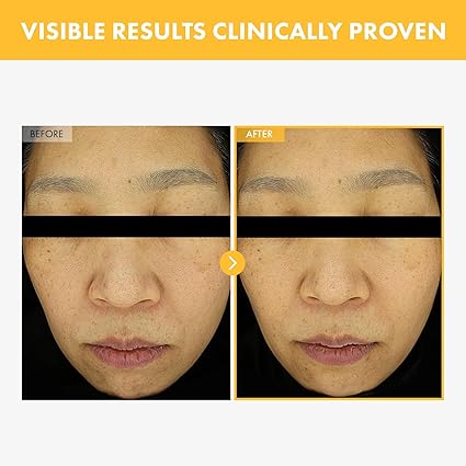 8 Days Spot Cream, Dark Spot Remover for Face, Age Spot, Sun Spot, Freckles, Melasma, Brown Spot Serum, Advanced Formula Corrector Cream with Niacinamide for Women and Men, 50g, 1.76 oz - Image 3