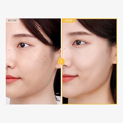 8 Days Spot Cream, Dark Spot Remover for Face, Age Spot, Sun Spot, Freckles, Melasma, Brown Spot Serum, Advanced Formula Corrector Cream with Niacinamide for Women and Men, 50g, 1.76 oz - Image 2