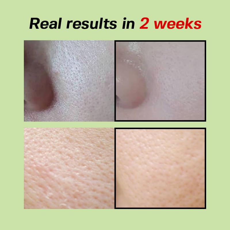 SUNGBOON EDITOR Green Tomato Pore Lifting Ampoule, Pore Minimizer Serum with Niacinamide & Green Tomato Extract, Hydrating & Firming Care for Sensitive Skin, Korean Skincare - Image 3