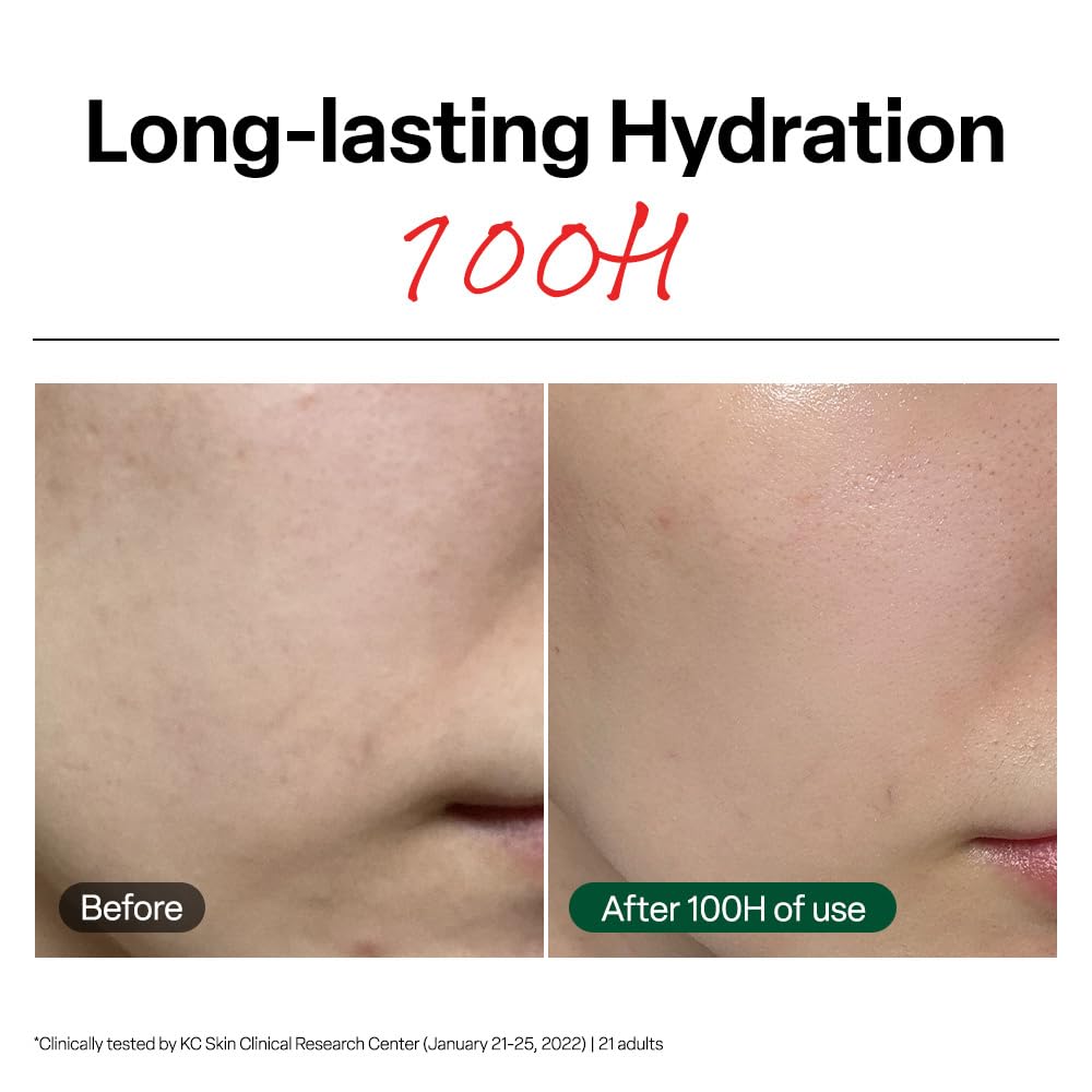 Dr. G R.E.D. Blemish Clear Soothing Cream - Calming Korean Moisturizer for Redness - Soothes Acne & Irritation - With Centella Asiatica - Long-Lasting Hydration - 2.36 fl oz - Image 3