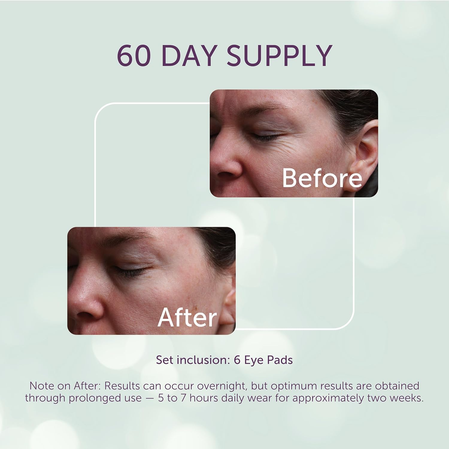 Silc Skin Silicone Eye Pads For Fine Lines, 60 Day Supply | Medical-Grade Reusable Overnight Eye Patches - Image 3