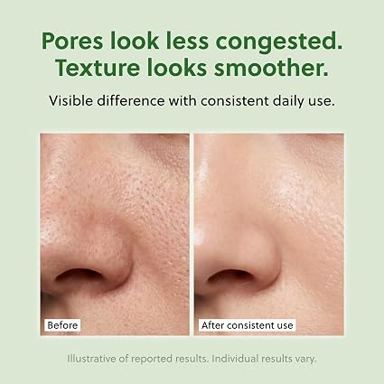 QUIA Toner Pads for Sensitive Skin – Dual-Sided Exfoliating and Hydrating Pads – Visibly Smoother Pores, Less Congestion – 70 Korean Skincare Pads - Image 2
