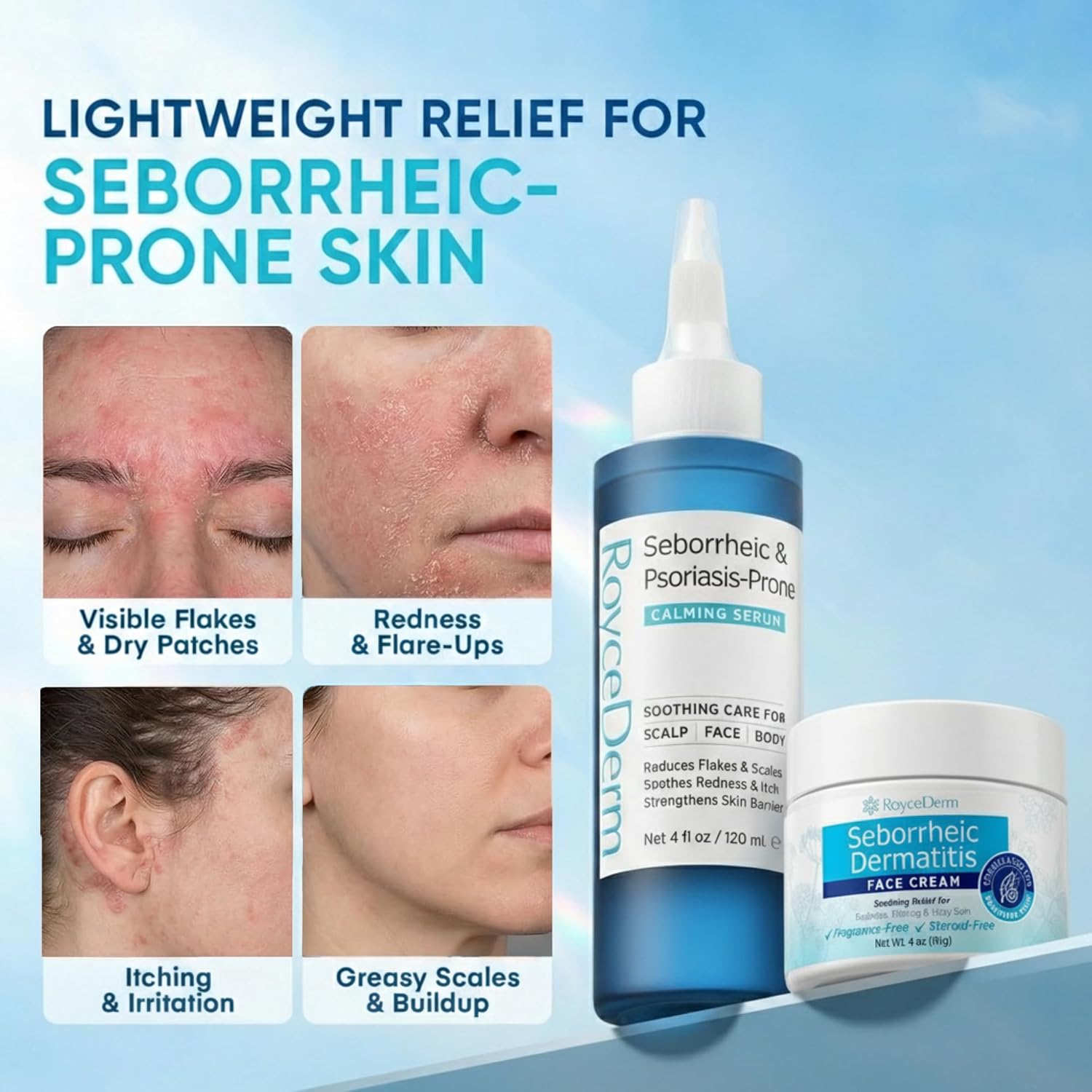Roycederm 2-Step Face Care Routine for Seborrheic Dermatitis-Prone Skin – Calming Serum & Soothing Face Cream - Image 2