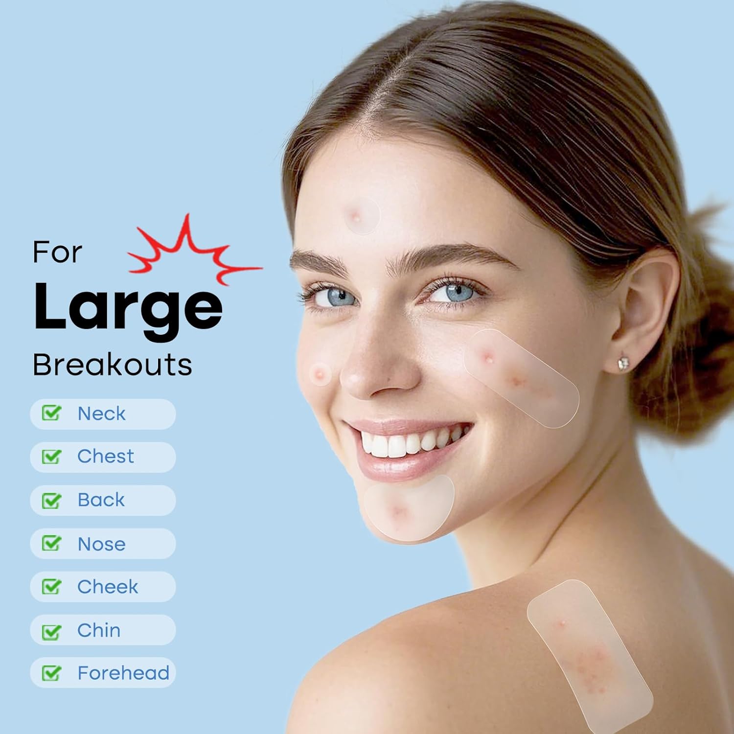 Large Pimple Patches Full Face,484 Patches,XL Acne Patches,Big Hydrocolloid Bandages for Body, Forehead, Chin, Neck Zit Breakouts w/Tea Tree, Salicylic Acid & Cica Oil|,Freely Customized Pimple Patch - Image 2