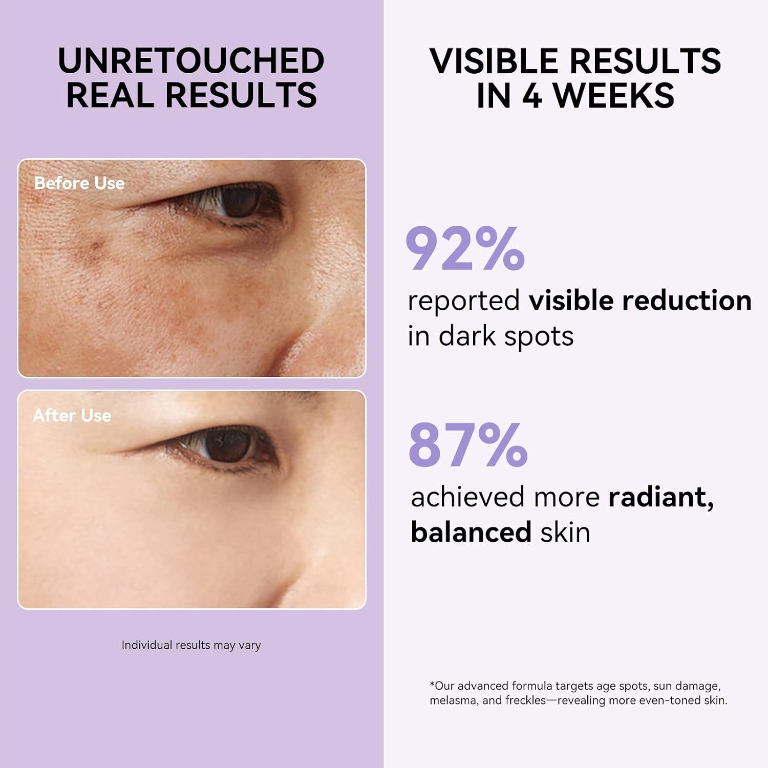 Dark Spot Remover for Face and Body - Dark Spot Corrector Serum for Sun Spots, Age Spots, Brown Spot,Freckles & Melasma - Skin Care Repair Evens Skin Tone for Women & Man Daily Use 1.69 FLoz - Image 3