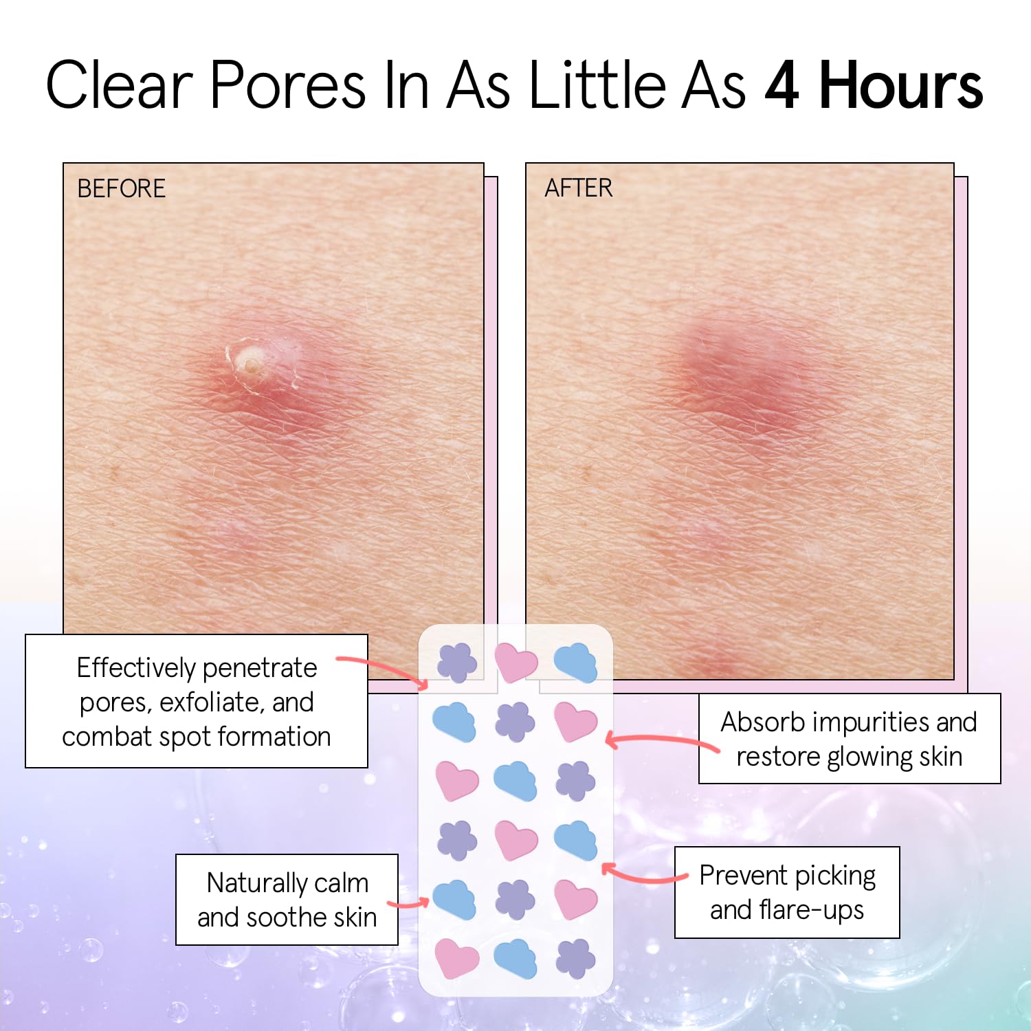 grace & stella Award Winning Pore Strip - Pimple Patches for Face - Hydrocolloid Acne Patches - Absorbs Zits, Reduces Redness - Cute Patches Dermatologist-Tested, Vegan (Multishape, 72 Count) - Image 3