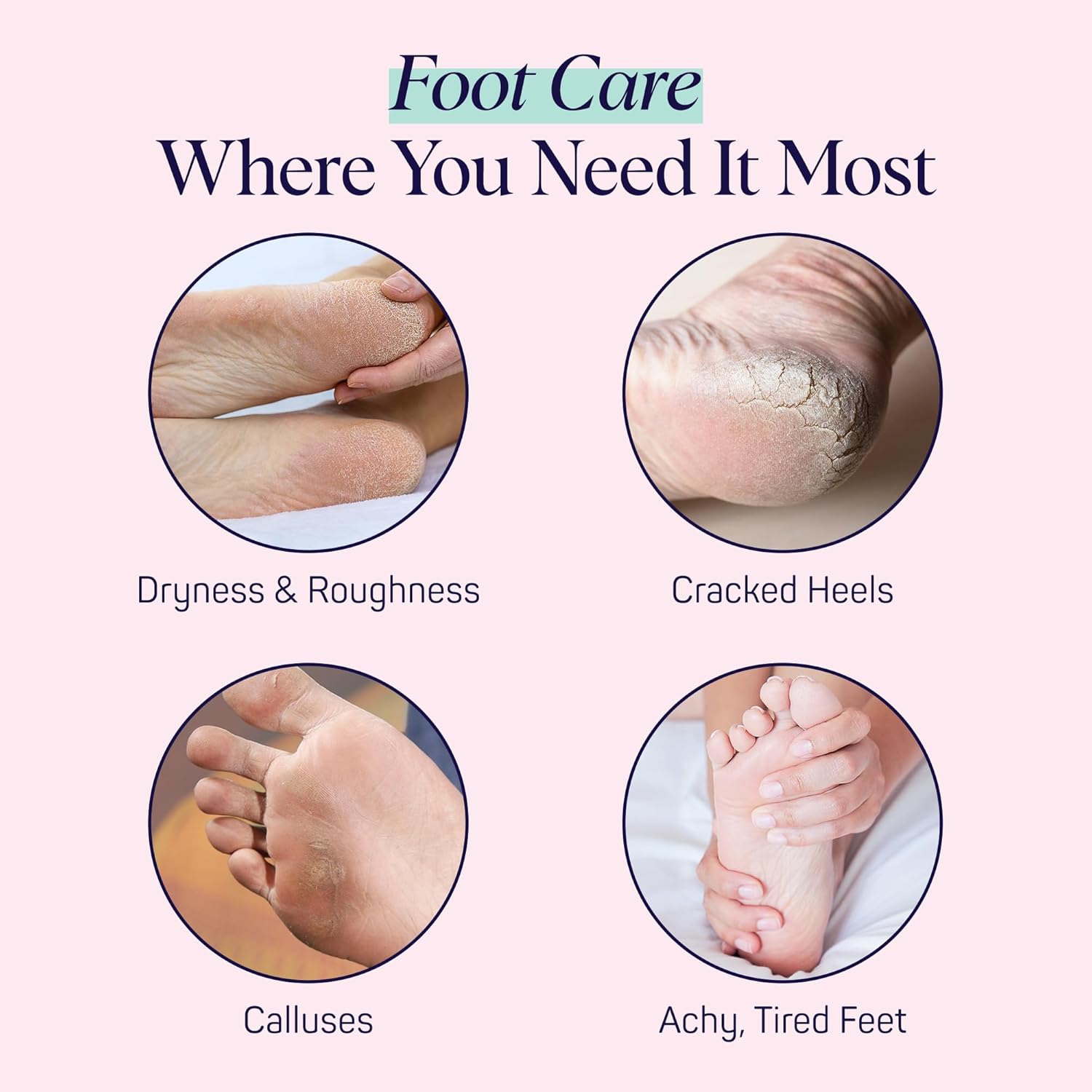 SpaLife Moisturizing Foot Sockies | Foot Mask for Dry Cracked Feet | Tea Tree Oil Softening Booties | Callus Remover Alternative | Self Care Gifts for Women | 8 Pack - Image 3