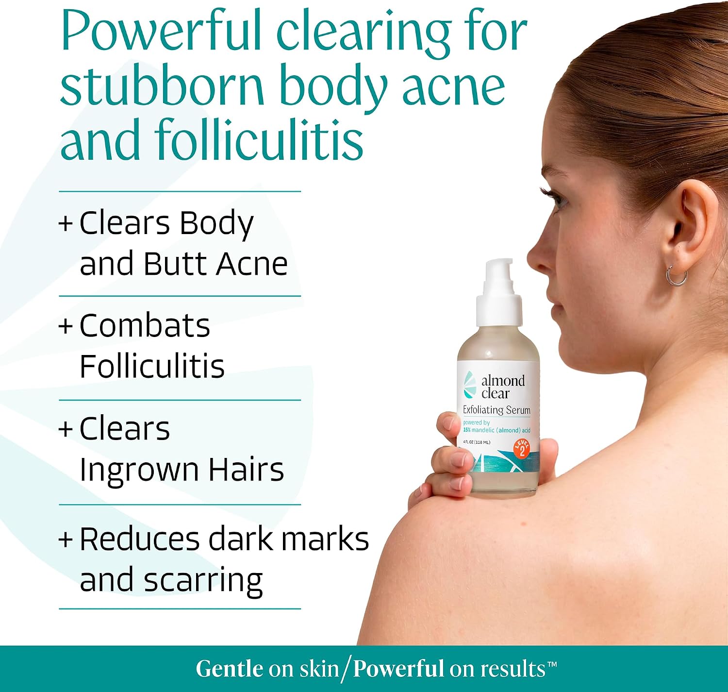 Almond Clear Mandelic Acid Level 2 Serum – Extra Strength Treatment for Body Acne, Folliculitis, and Ingrown Hairs – Buttocks Clearing Dark Spot Remover – 1 Fl Oz - Image 2