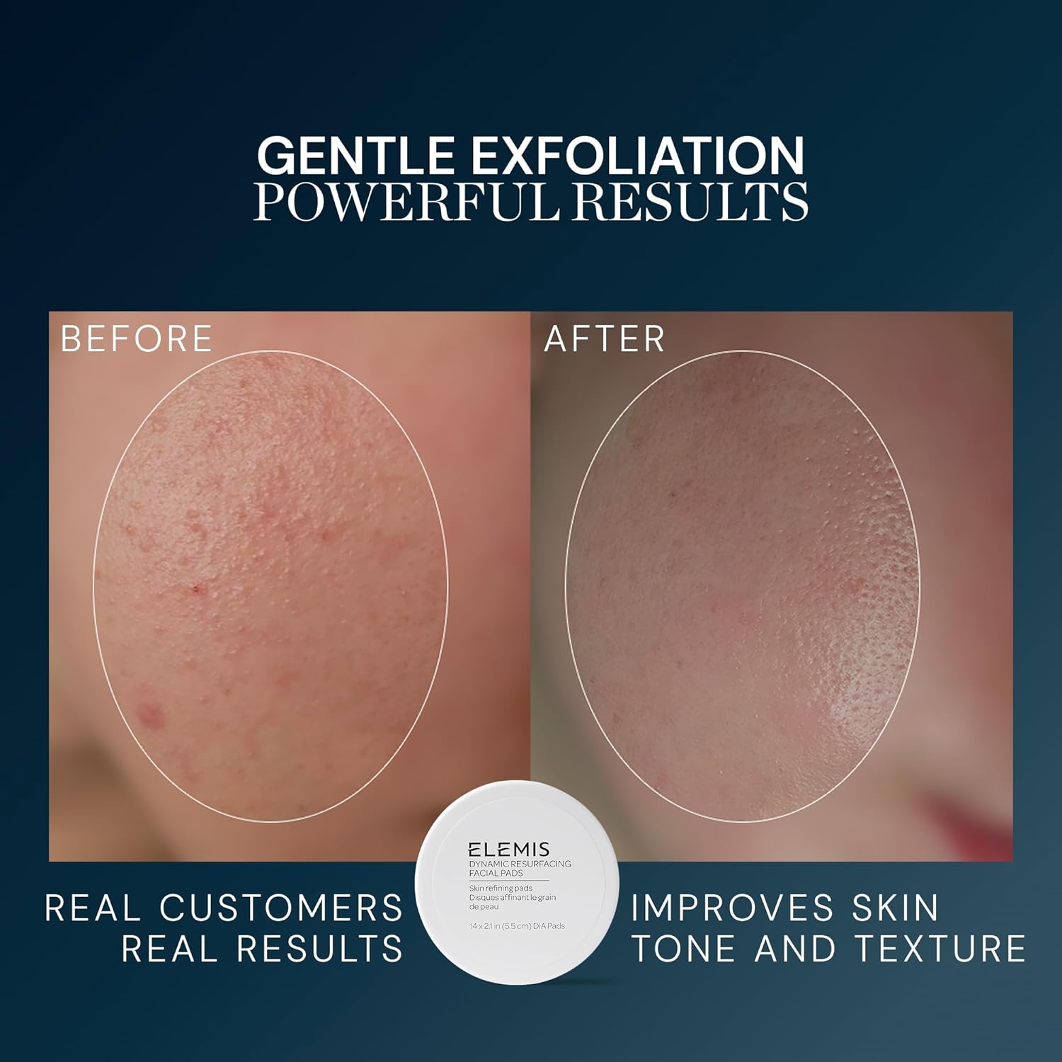 ELEMIS Dynamic Resurfacing Facial Pads, Gentle Textured Treatment Facial Exfoliating Pads - Image 3