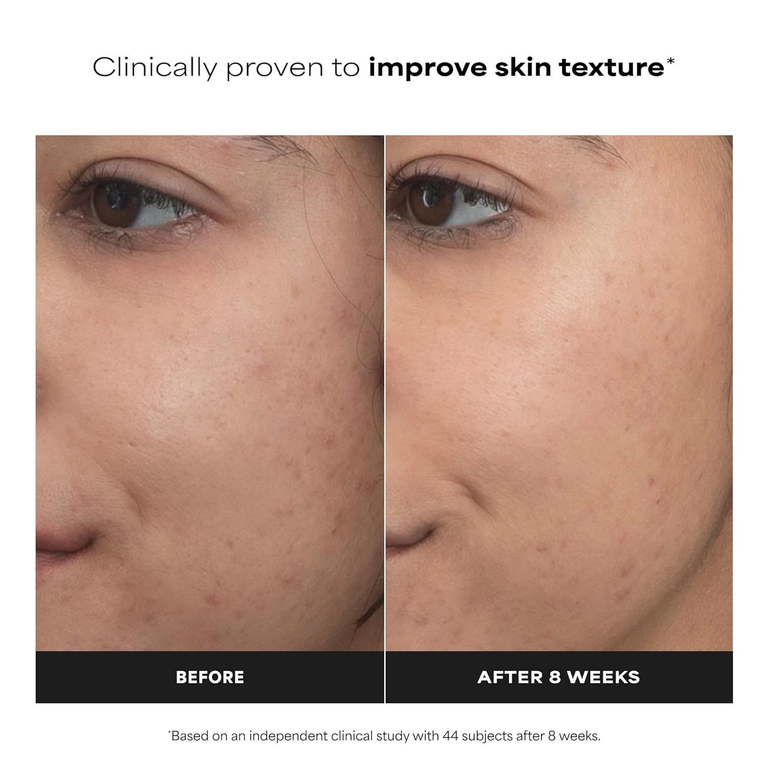 Paula’s Choice Pro Retinaldehyde Dual-Retinoid Face Serum Advanced Treatment, High Potency Anti-Aging Serum for Face, Breakout-Prone Skin, Radiance & Rough, Bumpy Texture, Fragrance-Free - Image 3