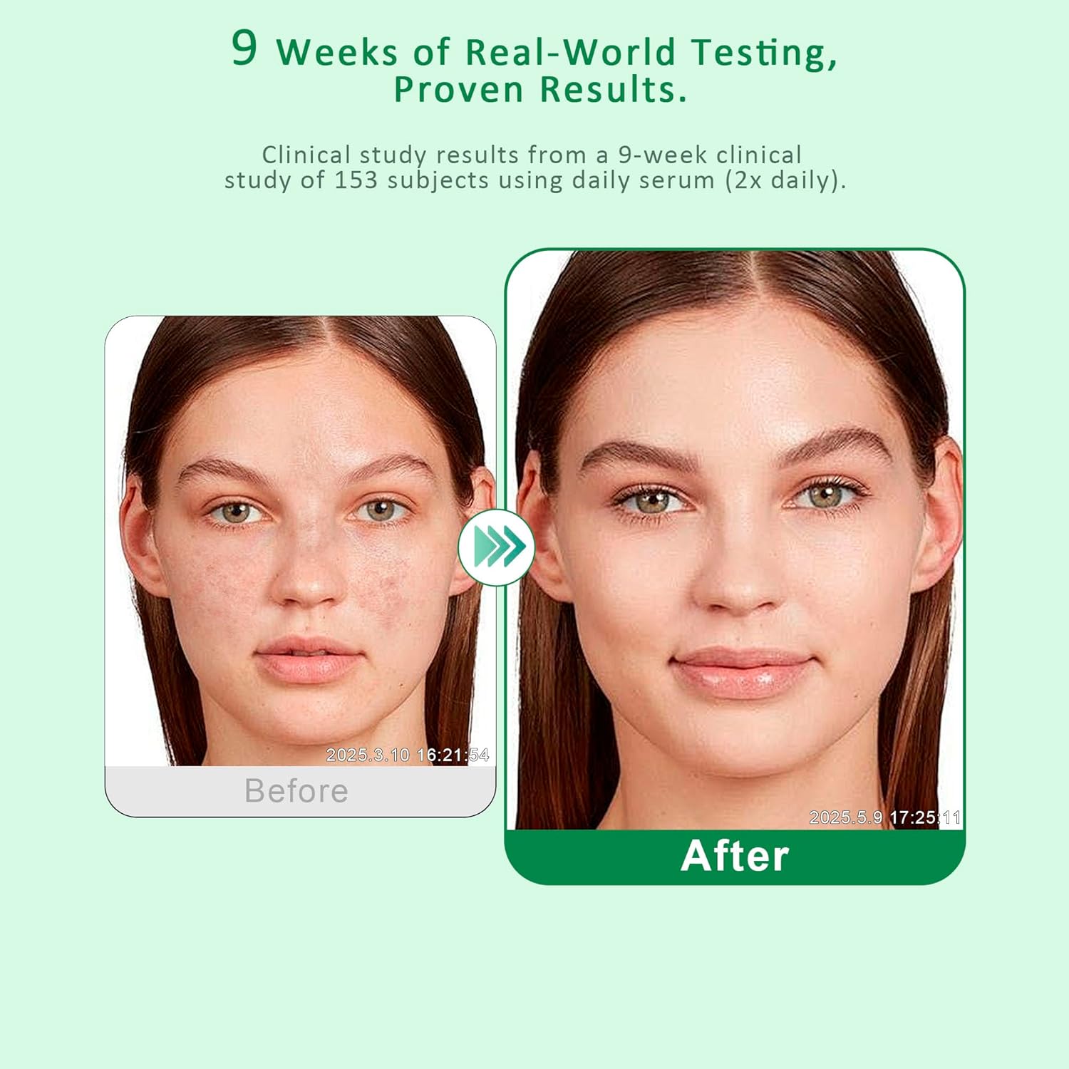 Dark Spot Remover for Face & Body – Dark Spot Corrector Serum for Hyperpigmentation, Brown Spots & Melasma Treatment - 1.69 fl oz - Image 3