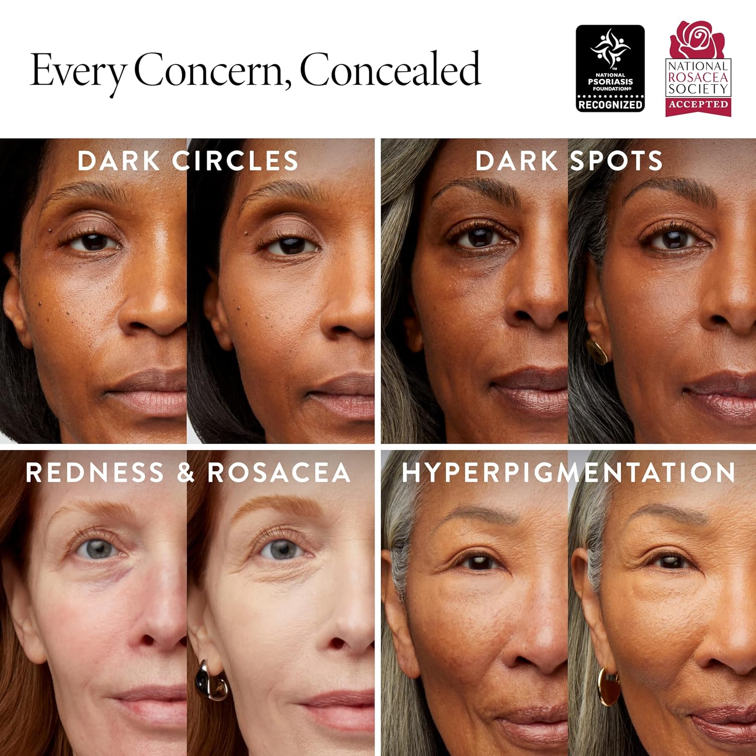 LAURA GELLER NEW YORK Ideal Fix Under Eye Concealer for Mature Skin – 05 Golden - Full Coverage, Anti-Aging, Color Correcting – Covers Dark Circles & Blemishes – Hydrating, Crease-Free, Long-Lasting - Image 2